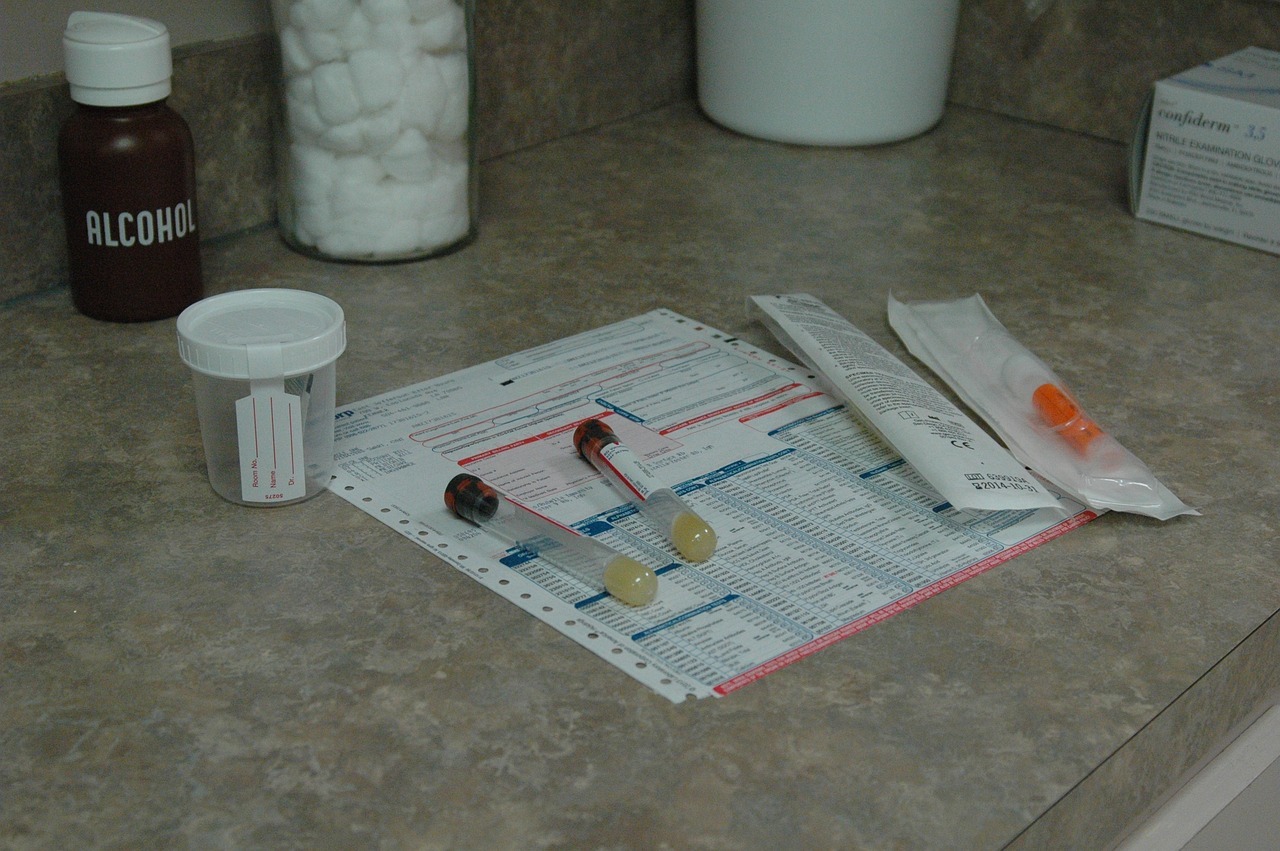 Urine Drug Test Tampering – What Employers Should Know